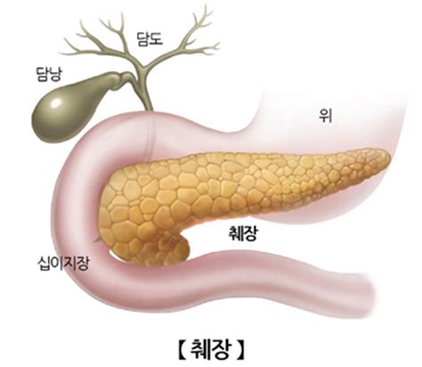 천영국 교수 비온뒤 방송 출연 영상. 건강 뱃속 더부룩..이럴땐 췌장암 전조증상 조심! - 거제저널