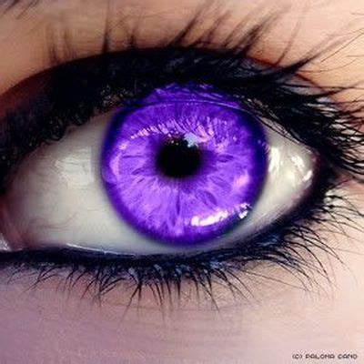 Part cat eye, part gemstone. Purple Eye Disease - Symptoms And Causes