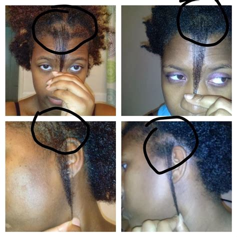 The basic principle remains the same, however. Kissi's Journey to Healthy Hair : Castor Oil Challenge Results