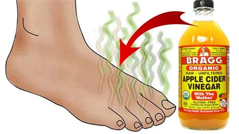 What does vinegar do to your feet? How To Easily Get Rid of Smelly Feet With Apple Cider ...