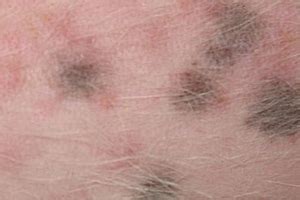 After biopsy it was seen to be prurigo nodularus. Dark Spots on a Dog's Stomach - How to Help Your Pet ...