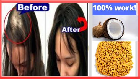 Castor oil has been used since ancient times for a whole host of problems from wart removal to thinning hair. How To Make Your Hair Grow with Coconut & Castor Oil - YouTube