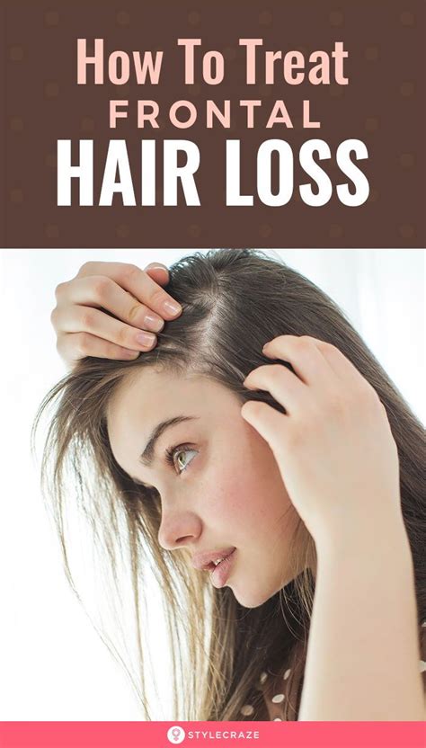 Frontal fibrosing alopecia (ffa) is a patterned form of scarring hair loss that occurs along the frontal hair margin. What Is Frontal Hair Loss And How To Treat It? (With ...