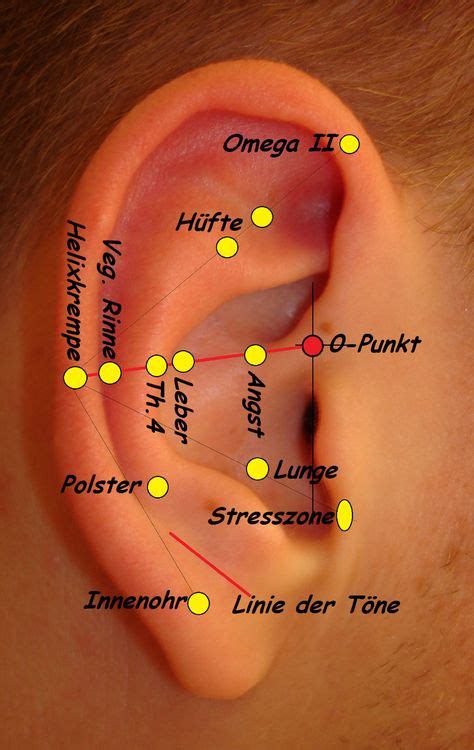 We have explored some of the common causes in an earlier post. Tinnitus Symptoms | Tinnitus symptoms, Treatment for ...