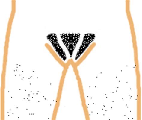 Ingrown pubic hairs occur when the tip of the hair grows back underneath the skin, which can often cause pain and irritation. Lets Talk about shaving: Female Pubic Hair Design Pictures