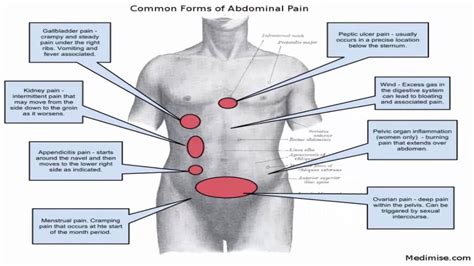 The rear side of the upper body is called the back, inside which the spine connects the upper body below the waist, on left and right, are the hips. Abdominal pain - YouTube