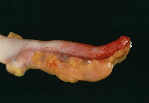 Maybe you would like to learn more about one of these? Appendix Example With Images / Appendix A: Best Practice ...