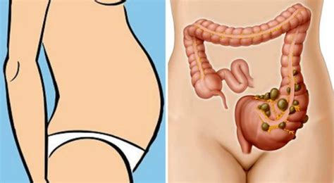 Learn about stomach cancer prognosis, including the percent of people who survive five years or more after a stomach cancer diagnosis. That's why you have swollen stomach pain and how to get ...