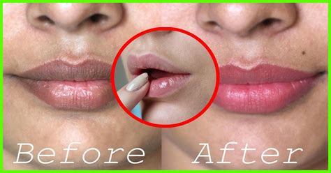 Any products/methods to get rid of that? How to get rid of black lips from smoking MISHKANET.COM