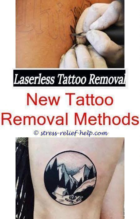 Do these peels penetrate deep enough to fade or remove a tattoo? Diy tattoo removal methods.Salabrasion tattoo removal before and after.How much is laser tattoo ...