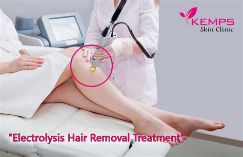 It is the only method that will completely remove pubic hair for good. What is the use of electrolysis in hair removal? | KEMPS ...