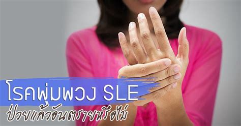 วินัย ไกรบุตร เป็นโรคอะไร พุ่มพวง ดวงจันทร์ เสียชีวิต ด้วยโรคอะไร เพราะเ. โรคเอสแอลอี SLE หรือ โรคพุ่มพวง ป่วยแล้วอันตรายหรือไม่ ...
