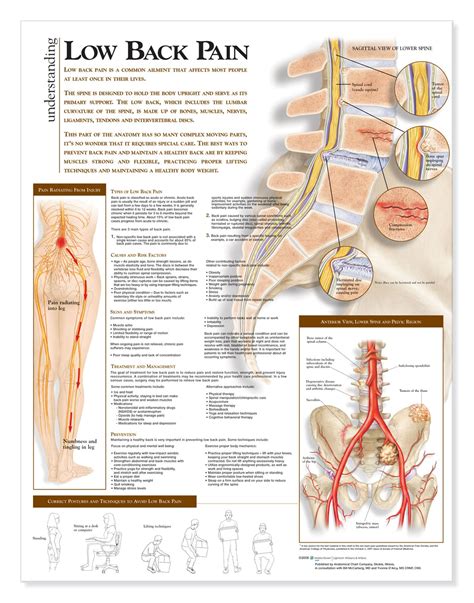 Muscle charts and stretching tips: Understanding Low Back Pain Anatomical Chart - Anatomy ...