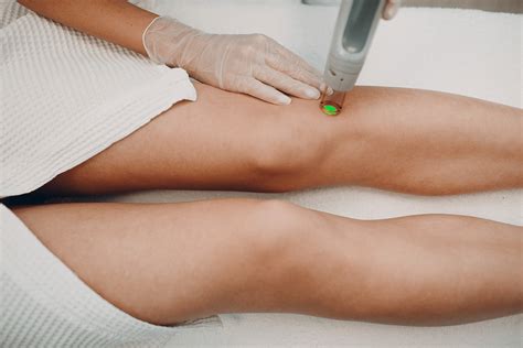 I had a good experience with my laser hair removal. Laser Hair Removal - What You Need to Know Before Booking ...