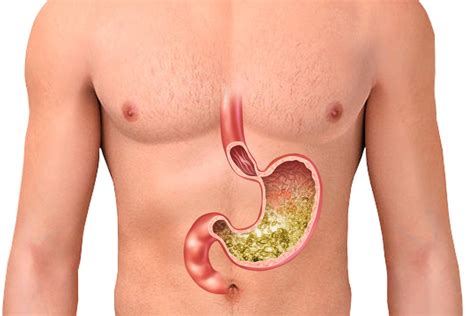 I have acidity problem should l drink hotwater. What is Gastric Acid (Stomach Acid)? Is It Diluted When We ...