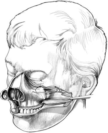 Maybe you would like to learn more about one of these? Total maxillectomy - Operative Techniques in ...