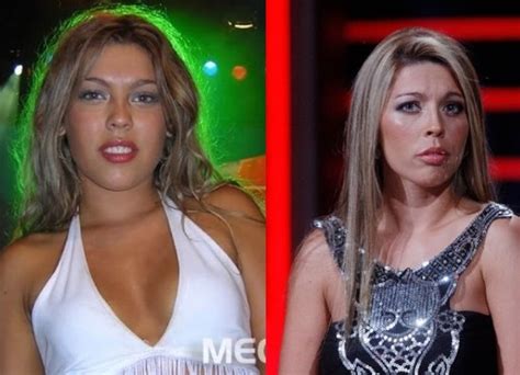 Tiene 28 años, es ex bailarina del programa mekano y actualmente se ocupa de su casa y sus dos hijos. Daniela Aránguiz detalló cada una de las cirugías a las ...