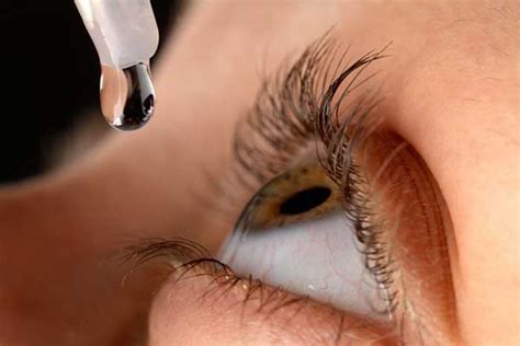 انواع مختلفی از اشک های مصنوعی ساخته شده اند روش دیگر درمان، نگه داشتن اشک در چشم است. برای خشکی چشم می توان اشک مصنوعی استفاده کرد؟ | دکتر گلدیس ...