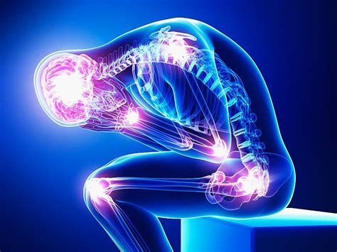 We did not find results for: Cannabinoids and Chronic Pain: Why Does Medical Marijuana Work? | OKKush.org