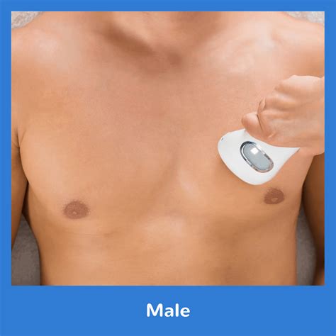 By the end of this. Male Laser Hair Removal - Indy Laser