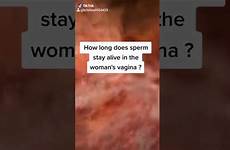 vagina sperm