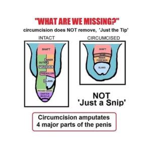 For some, circumcision is a religious concern. Male Circumcision Unkindest Cut - Freshmag