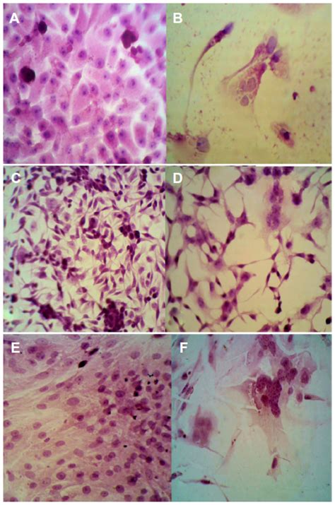 The 'vero' lineage was isolated from kidney epithelial cells extracted from an african green monkey (chlorocebus sp.; Full text Live attenuated measles virus vaccine therapy ...