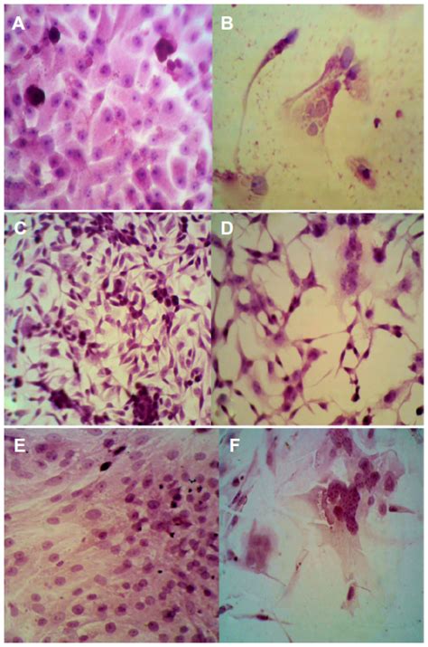 Each of the 3 strains of poliovirus is individually grown in vero cells, a continuous line of monkey kidney cells, cultivated on microcarriers. Full text Live attenuated measles virus vaccine therapy ...