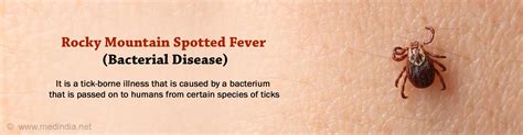 Rocky mountain spotted fever can be difficult to diagnose because the early signs and symptoms are similar to those caused by many other diseases. Rocky Mountain Spotted Fever - Causes, Symptoms, Diagnosis ...