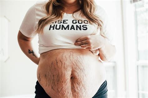 See more ideas about pregnant belly, pregnant, belly. 18 Women Who Showed Their Bodies After Pregnancy, and We ...