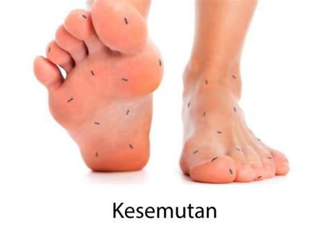 His tendons, bones, and flesh are damaged and have formed blood clots. Kesemutan??? Hati-hati Gejala Darah Beku - Biozatix ...