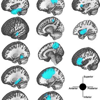 Search for text in url. Brain regions showed significantly different gFCD between ...