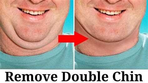 How to fix a double chin in photoshop with a few simple steps. How to remove Double Chin in Photoshop step by step ...