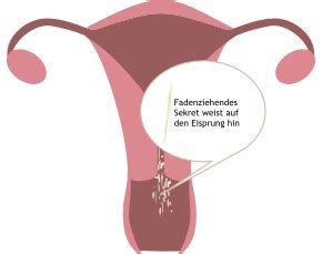 Der zervixschleim ist in den tagen vor dem eisprung meist spinnbar. Die Zervixschleim-Methode bei natürlicher Familienplanung ...