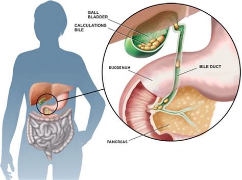 Selain itu, adanya gangguan proses. Gastritis Merupakan Panyakit Karena Gangguan ? - Obat ...