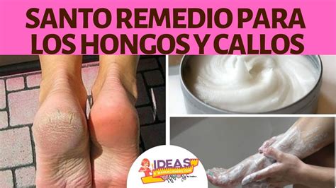 Es una erupción muy común que puede surgir a lo largo… Santo Remedio Para Eliminar Los Hongos Y Callos De Los ...