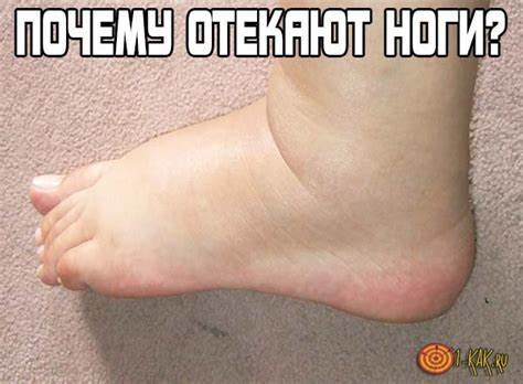 Похудеют ли ноги от велотренажера