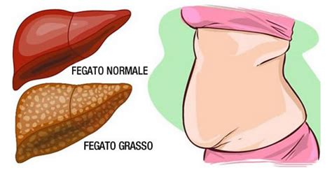 È in grado di regolarizzare i livelli di colesterolo e di pulire il fegato dalle scorie accumulate. 8 alimenti che bruciano e smaltiscono il grasso nel fegato