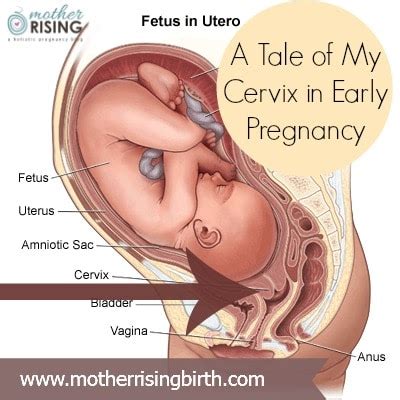 Get inspired by our community of talented artists. A Tale of My Cervix in Early Pregnancy - Mother Rising