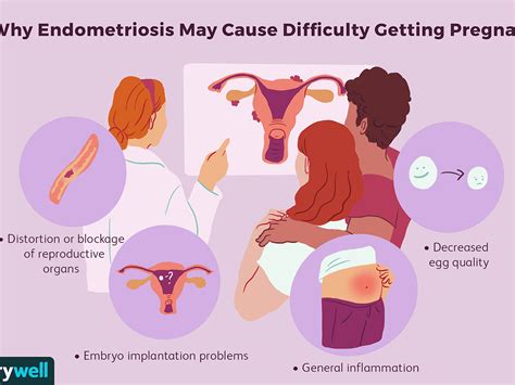 Endometriosis is the abnormal growth of endometrial cells outside the uterus. Endometriosis - Endometriosis happens when the endometrium ...