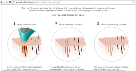 To achieve this approval, electronic devices have to pass rigorous safety. At-Home Laser Hair Removal Myths