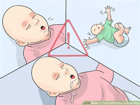 The mucus membranes not only get swollen and irritated. How to Treat Acid Reflux in Newborns: 11 Steps (with Pictures)
