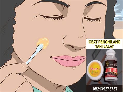 Ternyata, setiap letak dari tahi lalat punya makna sendiri, lho! Obat Menghilangkan Tahi Lalat Secara Alami