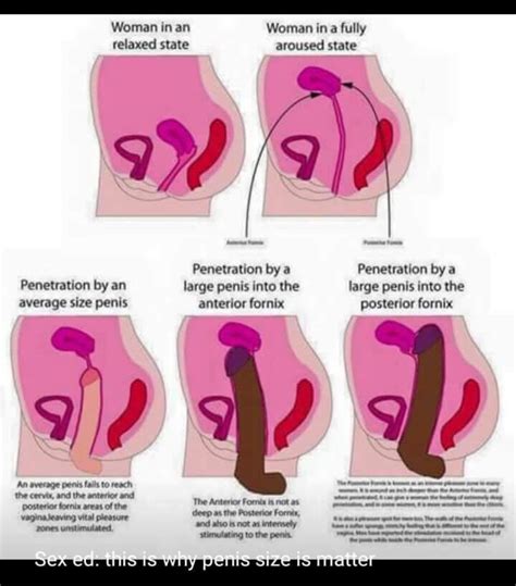 See all related lists ». "This is why penis size is matter" : badwomensanatomy