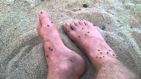 The black widow's fangs along with some pain and swelling at the bite site, the following symptoms can occur with a black. Krapets sand flies dance Hall - YouTube