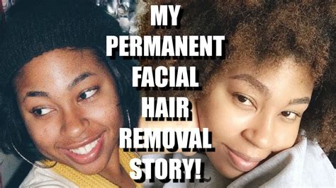 Better laser hair removal services in new york. MY PERMANENT LASER HAIR REMOVAL FACE STORY & 7 YEAR ...