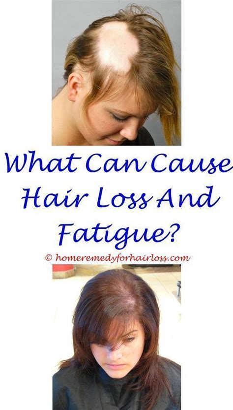The causes of female hair loss are often related to a hormonal imbalance. hormone vitamins for hair loss - stress hair loss recovery ...
