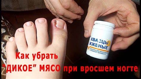 Приготовить мясо при диете