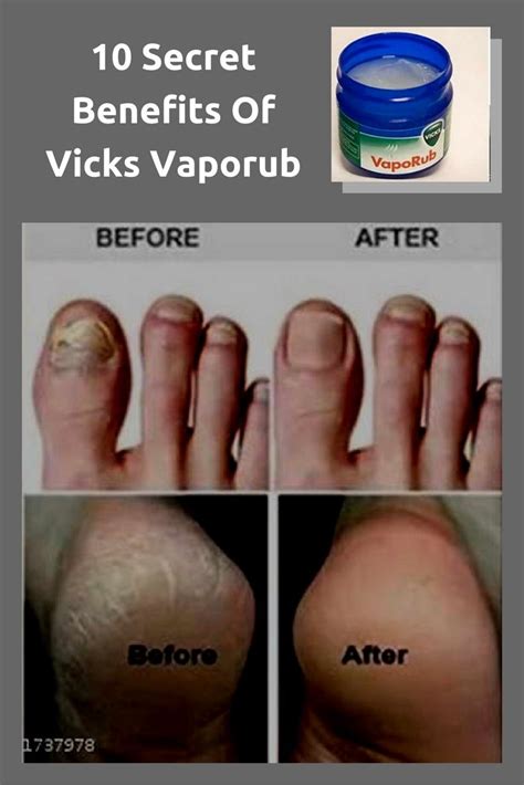 10 Secret Benefits Of Vicks Vaporub | Vicks vaporub, Workout at work, Vicks