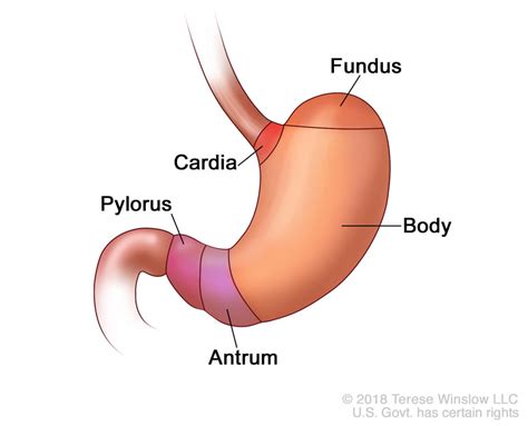 The cancer has not spread to lymph nodes or other tissues or organs, but has grown through the main muscle layer of the stomach wall into the subserosa (the thin layer between the main muscle layer of the stomach and the outside membrane of the stomach, called the serosa). Changing U.S. Incidence of Lower Stomach Cancer - National ...